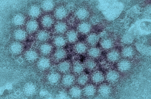 Public urged to be alert to signs and symptoms of norovirus as cases up over 50% in a week - The Journal