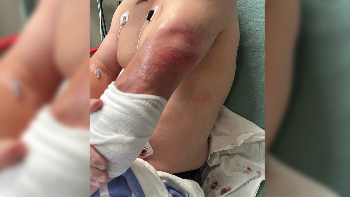 scraped and bandaged arm of ICE agent