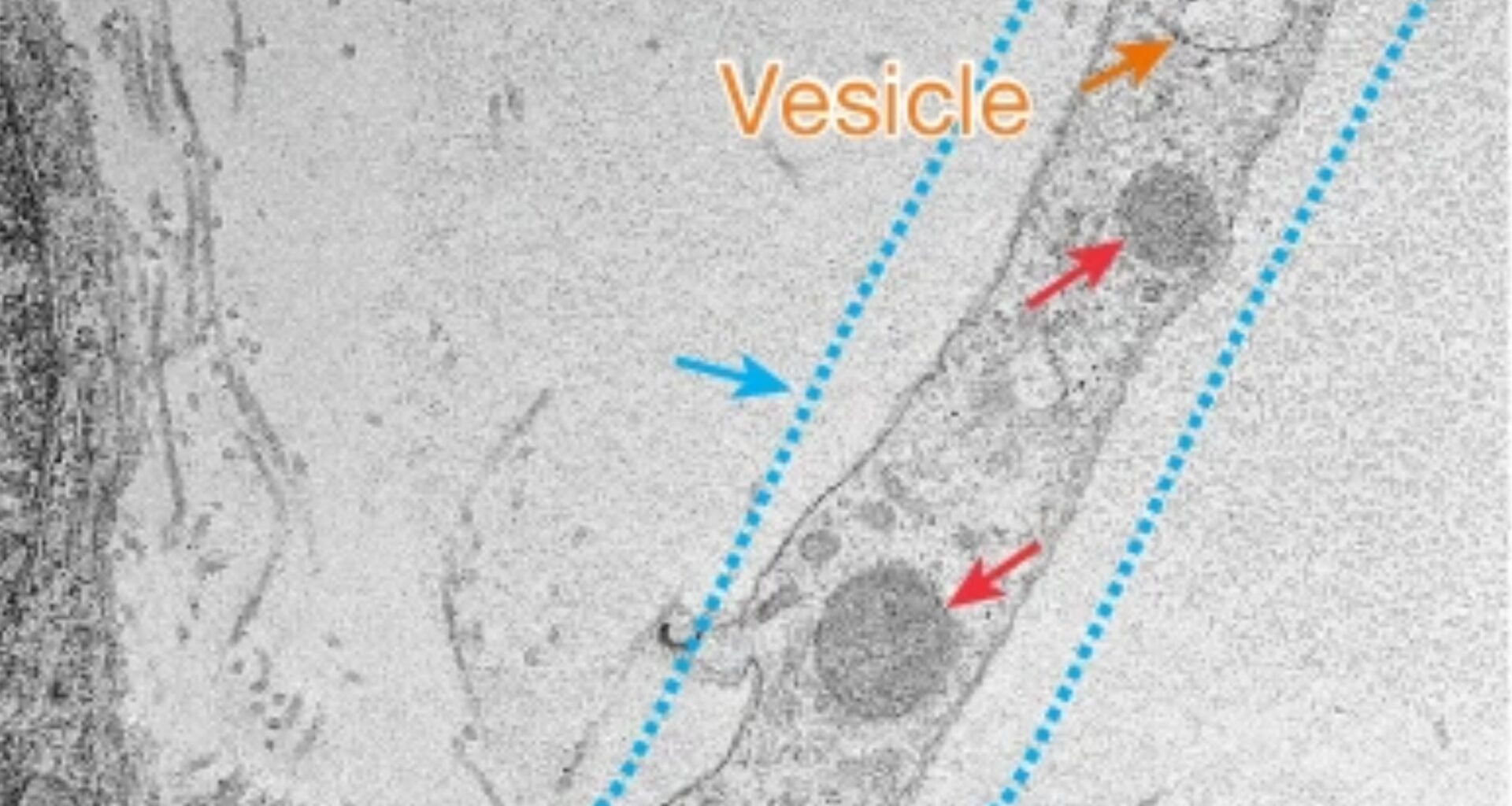 Scientists discover that nerve cells ‘borrow’ power to survive pain