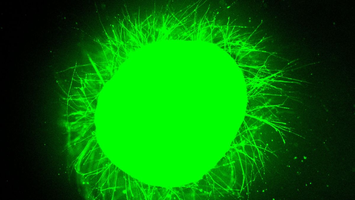 Scientists Grew Mini Human Spinal Cords, Then Made Them Repair After Injury : ScienceAlert