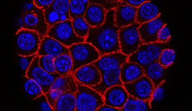 ECM Sensing Shapes Pancreatic Cancer Resistance