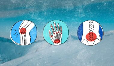 sore muscles and joints in cold weather