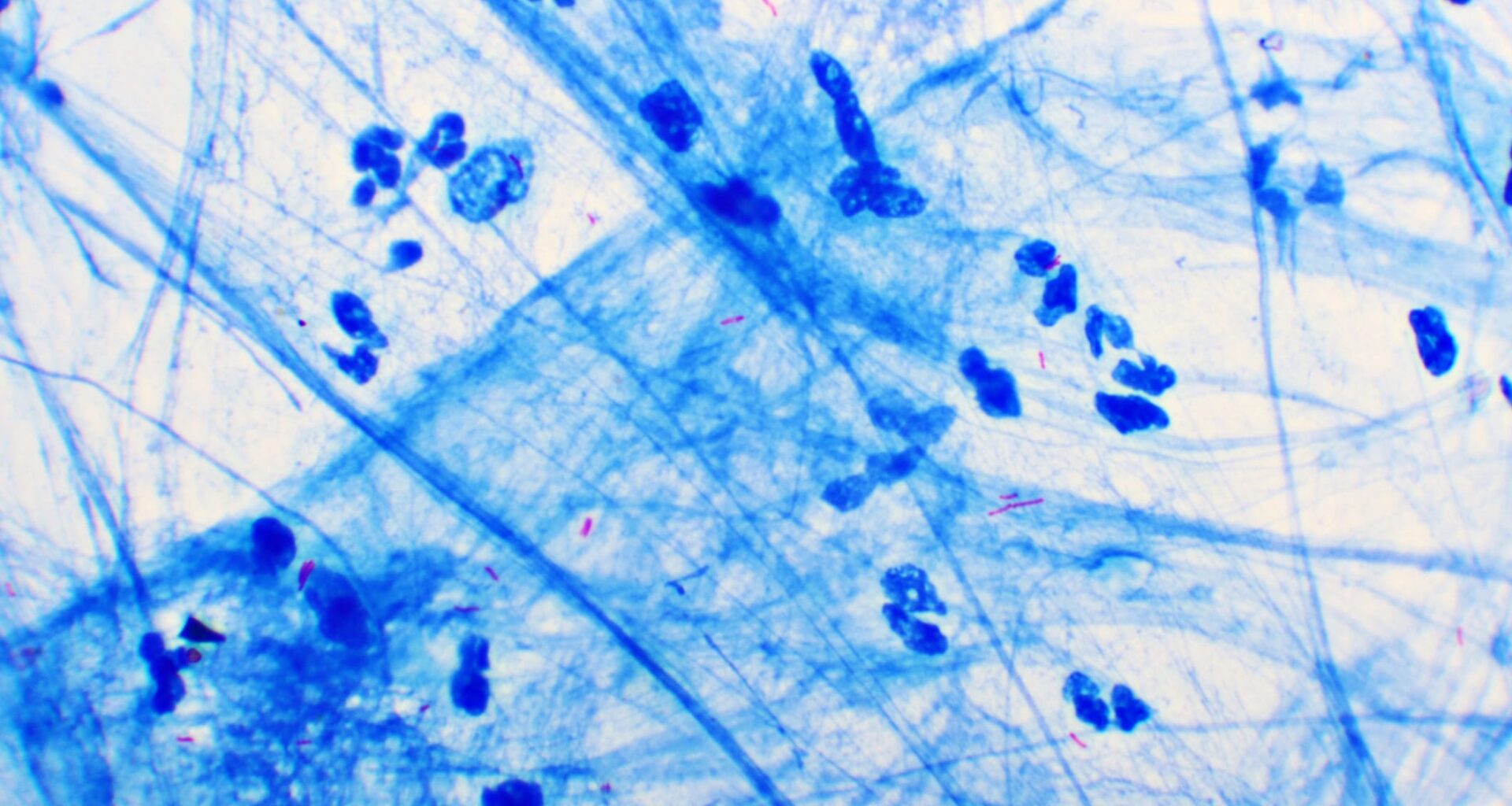 Tuberculosis Mycobacteria Use Stealth to Evade Immune System