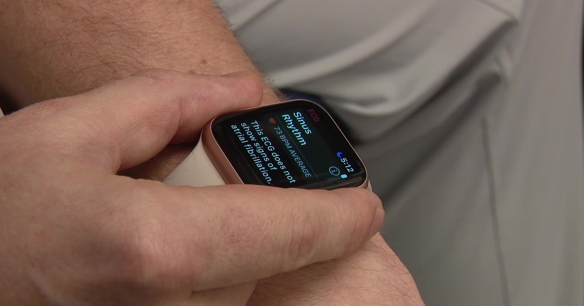 Smartwatch Health Alerts: Tampa cardiologist shares when to see a doctor