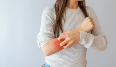 Scientists discover hidden sugar layer behind psoriasis