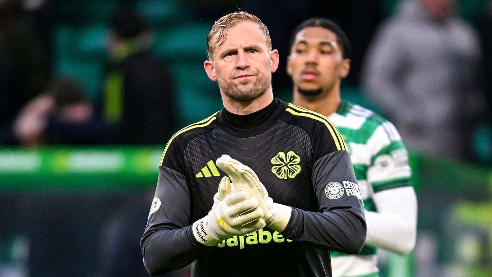 Schmeichel fears career is over as double surgery looms