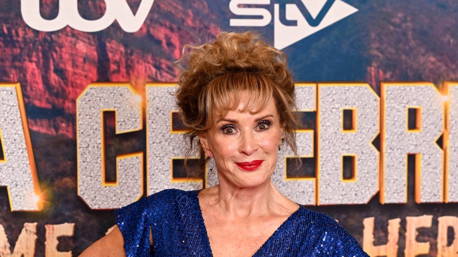 Callard says I'm A Celeb helped with her low self-esteem