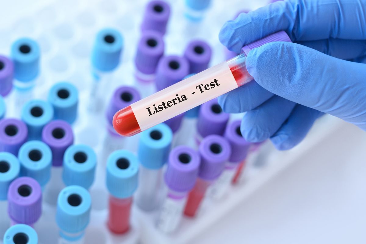 Doctor holding a test blood sample tube with Listeria bacteria test - stock photo