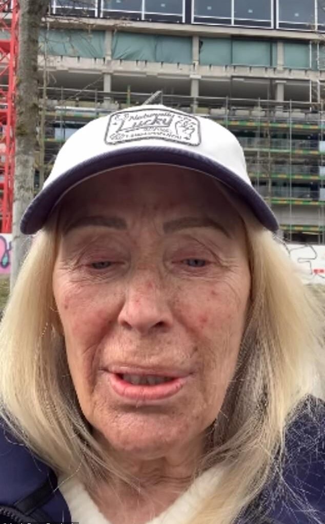 Angie Best has revealed she 'doesn't want to go out in public' or have anyone see her as she suffers from a acne breakout amid her cancer treatment