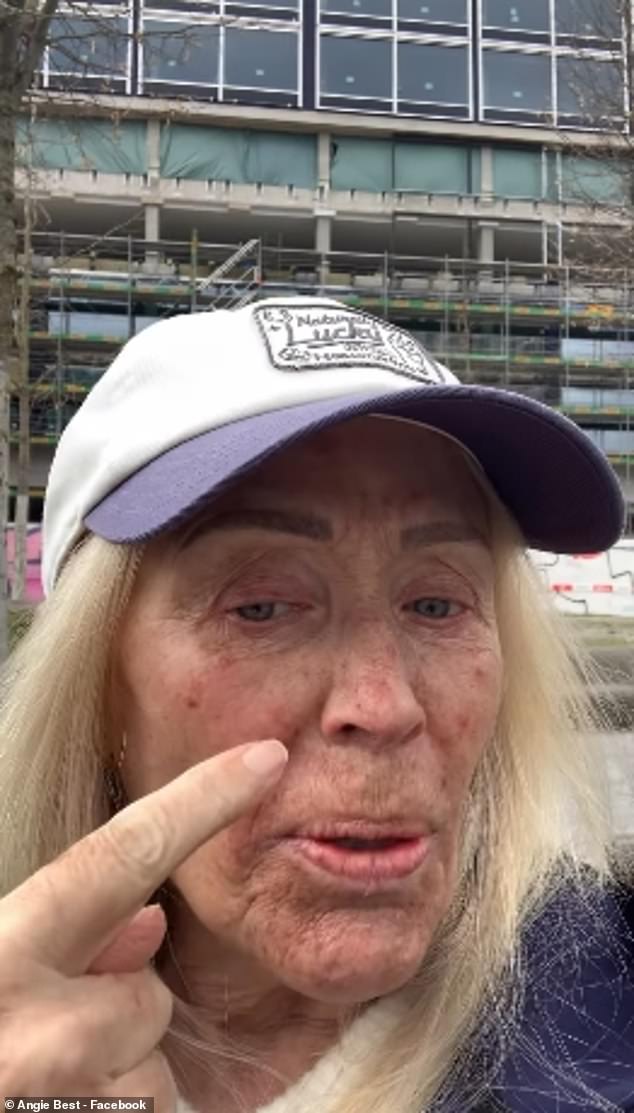 Chemotherapy can cause acne or acne-like rashes while targeted therapies can also lead to the skin becoming itchy and more sensitive