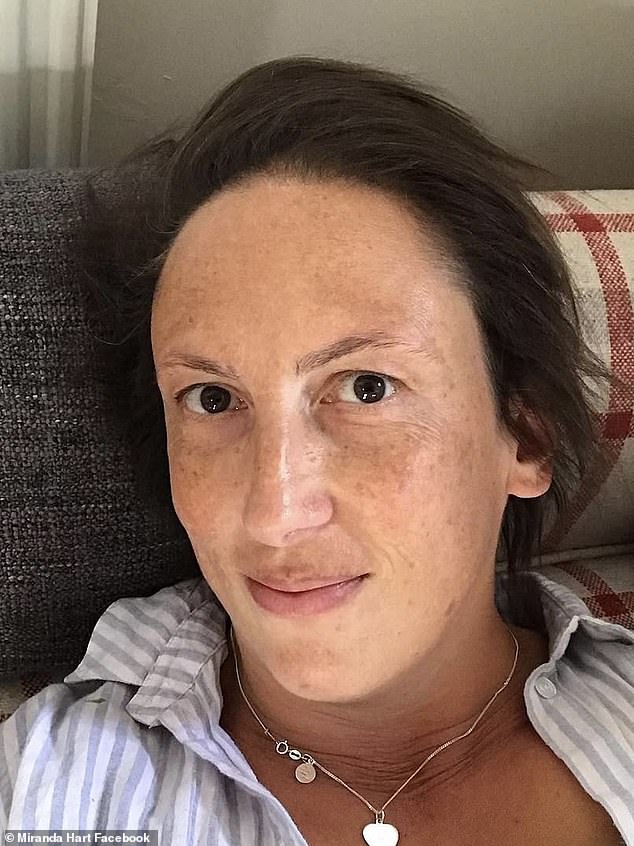 Miranda Hart revealed on Facebook on Wednesday that she has hurt her ankle and can't walk properly as she opened up about her extreme fear of healthcare