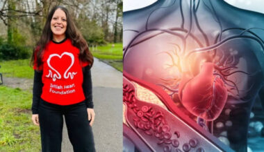 Heart Stopped 14 Seconds: Stroke Survivor’s Story | Health