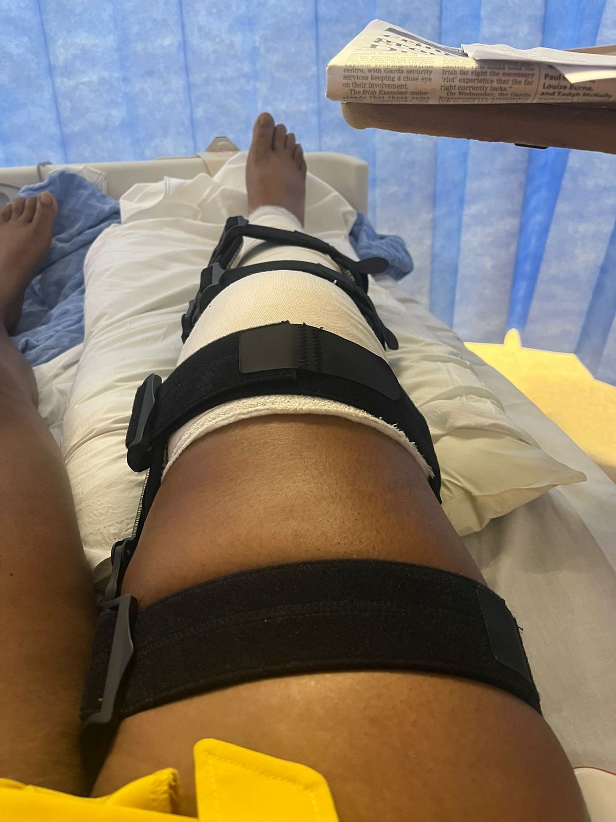 Junia Van Belle's leg 