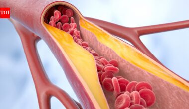 Artery ageing in your 30s? Doctors reveal early warning signs and lifestyle changes that can protect your heart