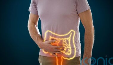 5 key bowel cancer signs to never ignore