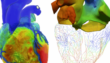 Living Heart Project Builds Virtual Twins for Medicine