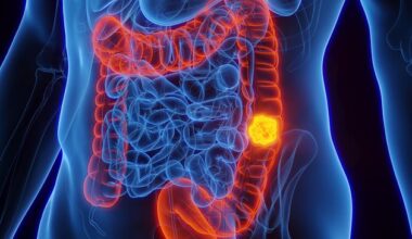 €670,000 funding for blood test to detect bowel cancer could save more patients