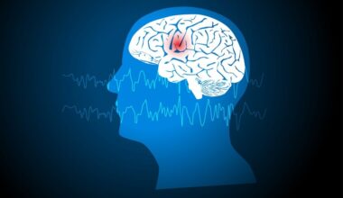 Zorevunersen Results in Dravet Syndrome - EMJ