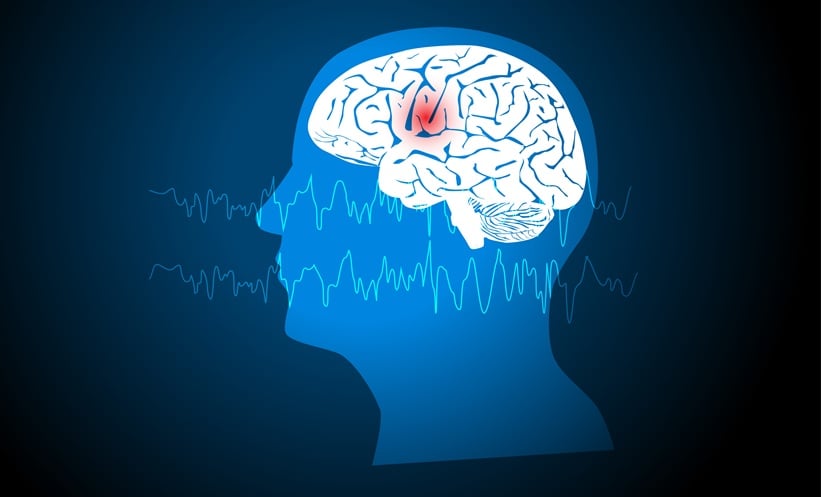Zorevunersen Results in Dravet Syndrome - EMJ