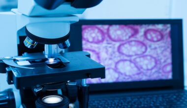 Transperineal vs Transrectal Prostate Biopsy: Safer Option Emerges