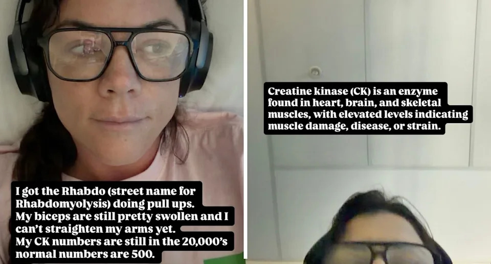 She was diagnosed with a rare muscle condition called rhabdomyolysis. Source: Instagram/Em Rusciano