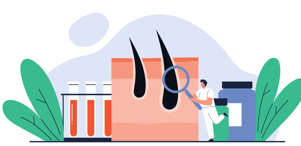 illustration depicting a researcher examining hair follicles with test tubes and bottles of chemicals nearby
