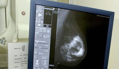 Tipperary nurse sues over alleged delay in breast cancer diagnosis - Homepage