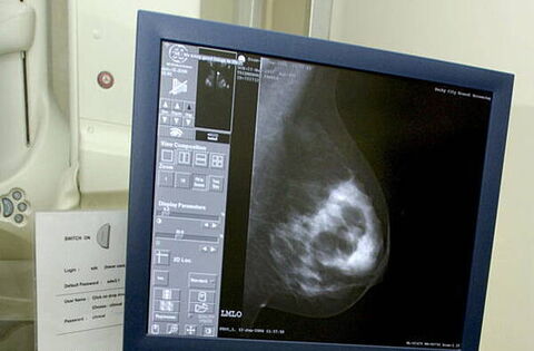 Tipperary nurse sues over alleged delay in breast cancer diagnosis - Homepage