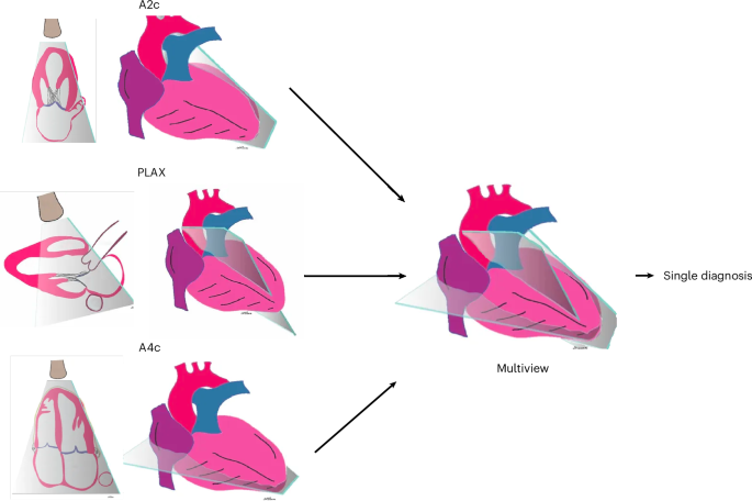 Multiview deep learning improves detection of major cardiac conditions from echocardiography