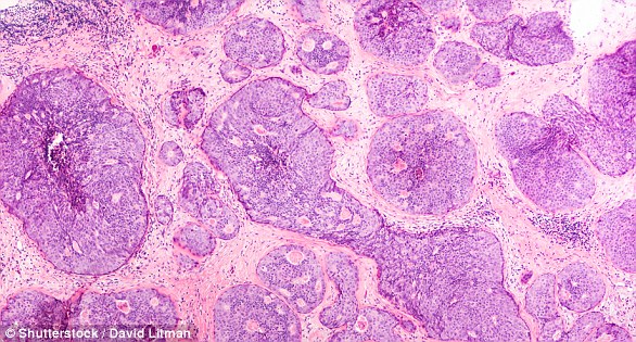 Beverley Callard reveals her mind is 'manic' while preparing to return to work in a health update following her breast cancer surgery