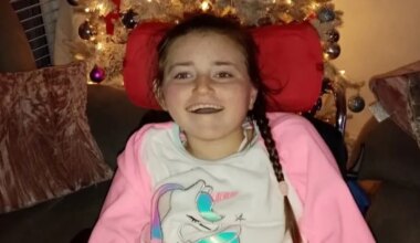 Scoliosis death blamed on Children’s Health Ireland failure