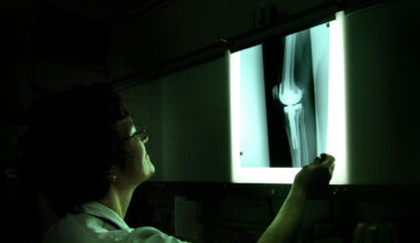 Tutor quits UCC radiography course over lack of time students work with patients