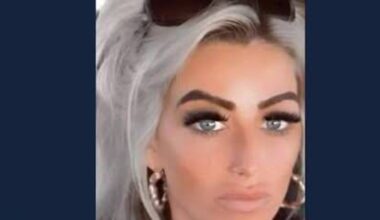 Scarlett Faulkner still in critical condition at CUH after roadside attack