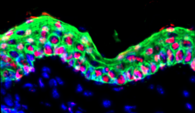 Key Driver of Long-Term Inflammatory Memory Identified