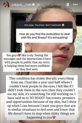 Mikayla Matthews on her Instagram Stories on March 18.Credit: mikayla__matt/Instagram