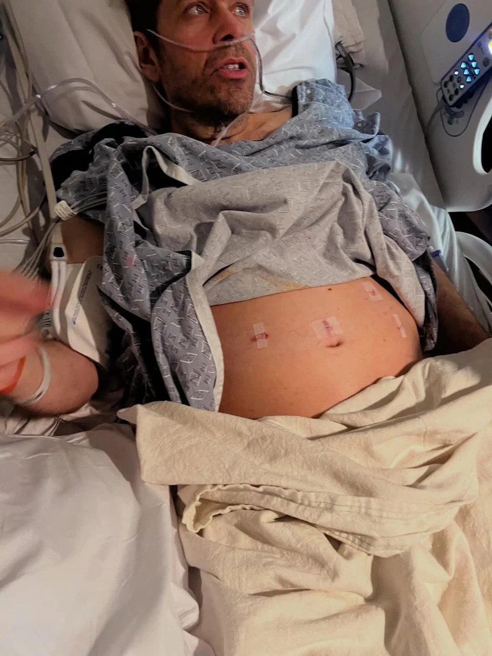 Perez Hilton Posts Dramatic Hospital Pics Amid Health Issue 2