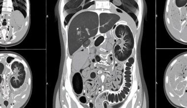Rising CT Scans in Elderly Raise Radiation Questions – EMJ