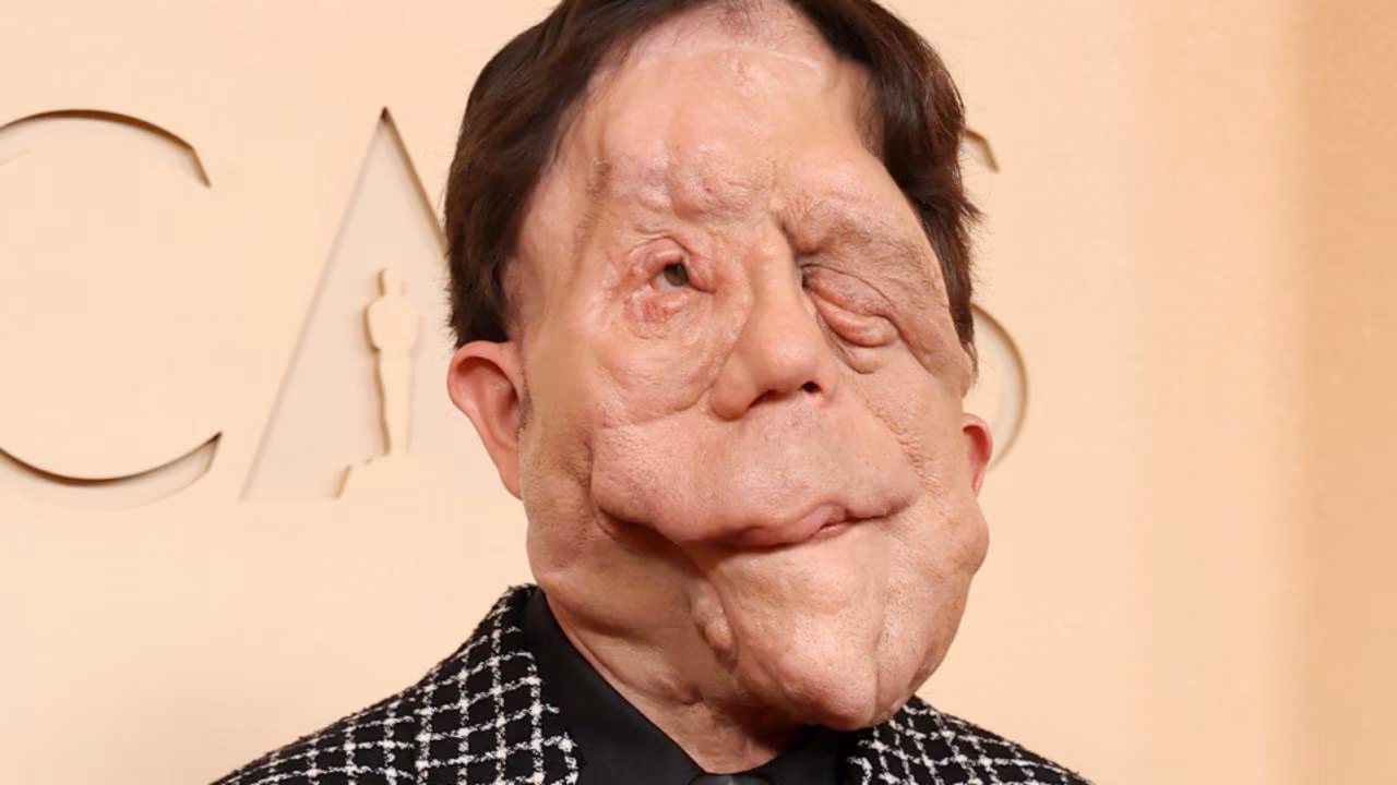 Actor Adam Pearson hits back at comedian’s cruel tweet about him