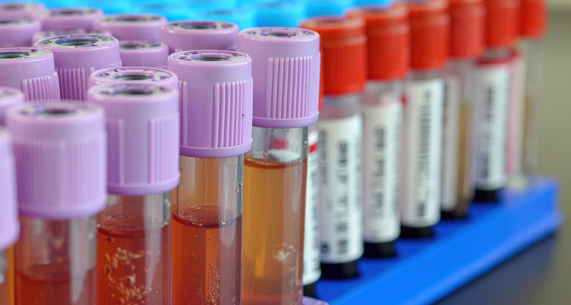 AI can determine time of death from a single blood sample