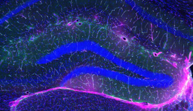 Exercise Protects Against Alzheimer's, And Scientists May Finally Know Why : ScienceAlert