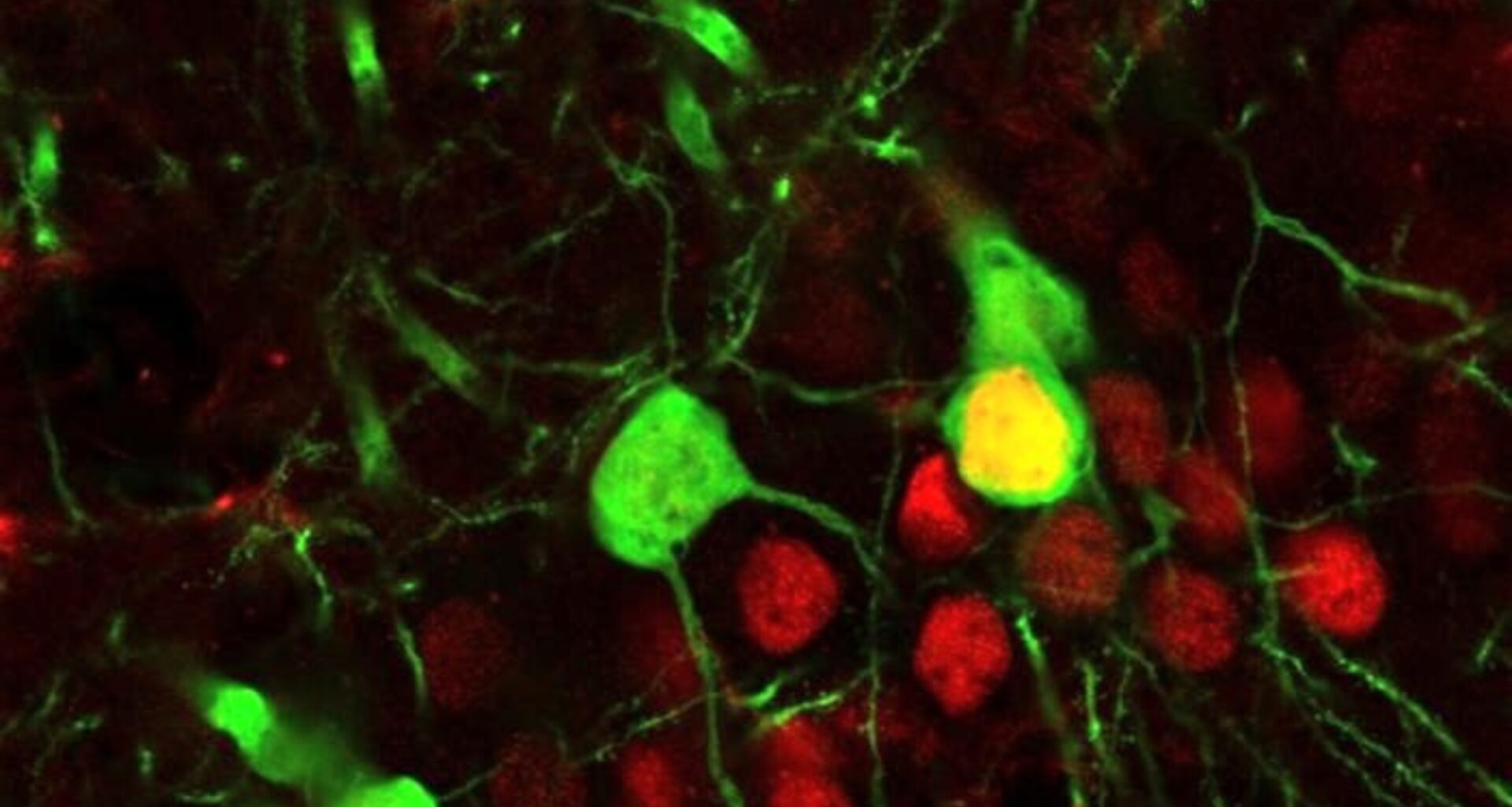 Cocaine rewires brain circuits in ways that can trigger relapse