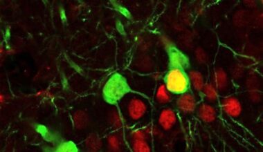 Cocaine rewires brain circuits in ways that can trigger relapse