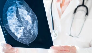 Nurse sues in the High Court over alleged delay in breast cancer diagnosis – The Irish Times