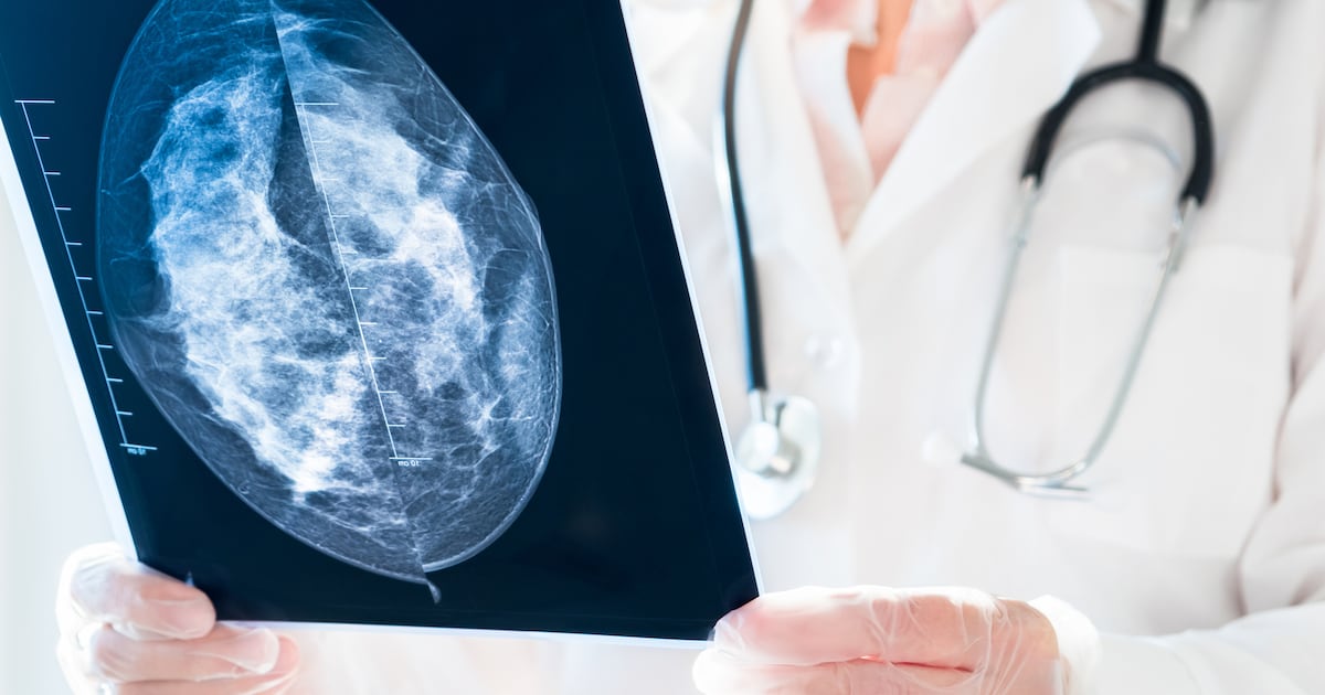 Nurse sues in the High Court over alleged delay in breast cancer diagnosis – The Irish Times