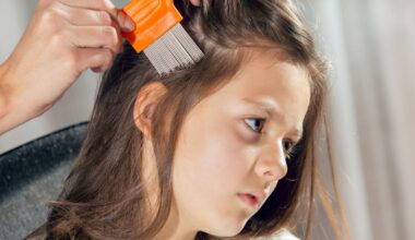 Your friends with school-age kids are in the trenches with nit lotion and the little comb – The Irish Times