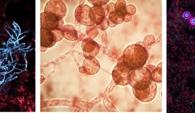 The race to beat deadly, drug-resistant fungal diseases