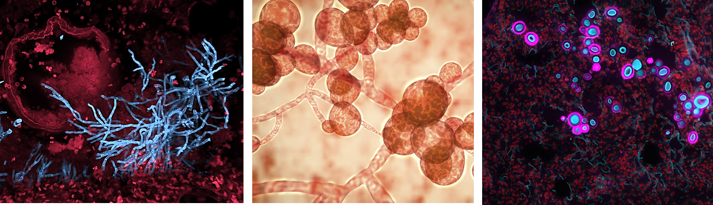 The race to beat deadly, drug-resistant fungal diseases