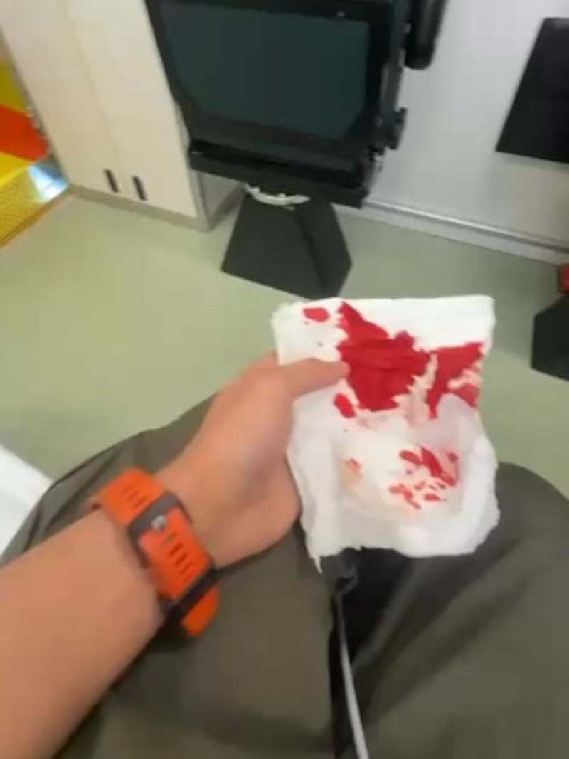 Ibrahim said he was bleeding heavily after the incident on March 22nd