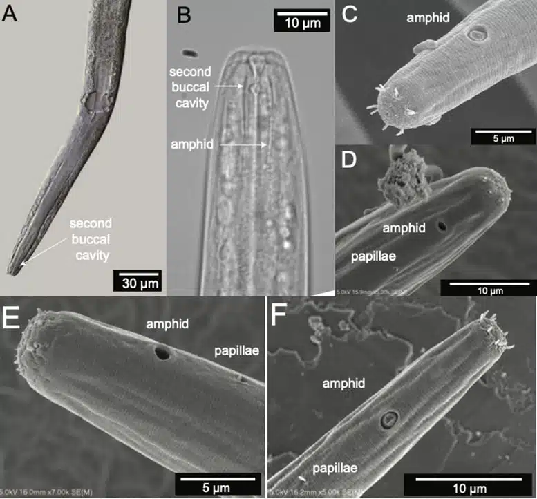 Microscopic Images Of Diplolaimelloides Woaabi, The Newly Identified Nematode Species From Great Salt Lake