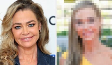 Denise Richard Posts Facelift Results